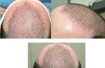 Mega Transfer - Foto 1