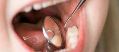 odontopediatria-joao-pessoa-1411741800